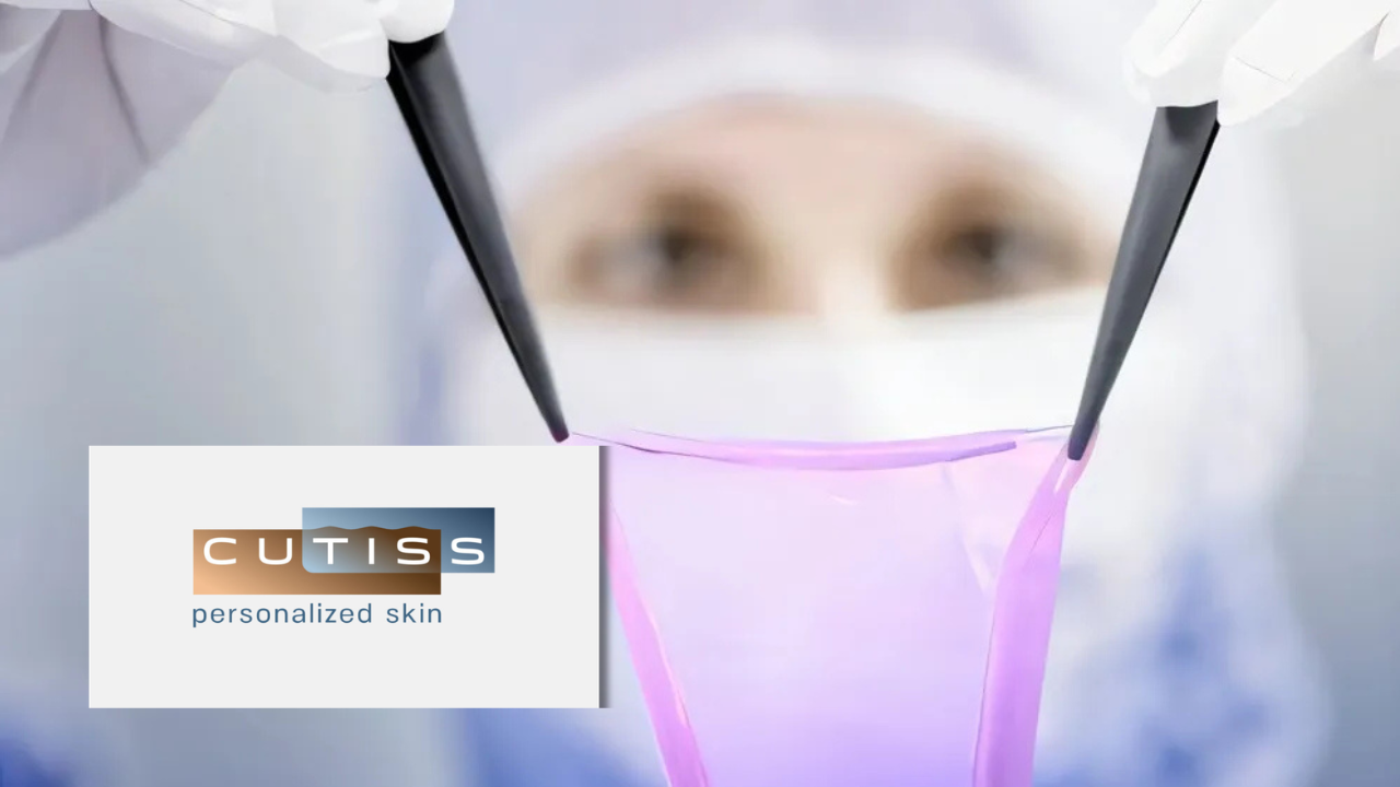 Close-up of gloved hands using surgical instruments to hold a translucent pink skin graft material, next to the Cutiss "personalized skin" logo.